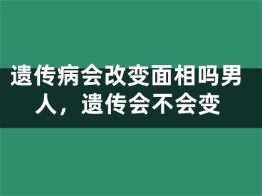 遗传病会改变面相吗男人，遗传会不会变